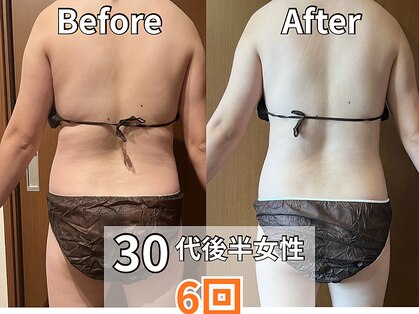 マロカ(Marroka)の写真