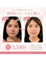 至福のひととき/ハーブピーリング初回3,500円