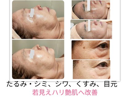 庭夢エステの写真