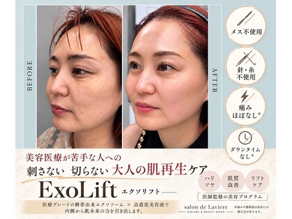 サロン ド ラヴィエール(salon de Laviere)の写真
