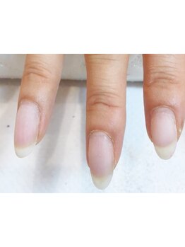 爪の悩みを解消できる（ケア含む）