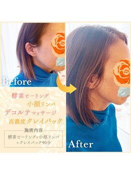 マリーゴールド(marigold)/小顔リンパマッサージ☆