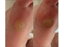 アベビー(Abeby)/靴も併せて見直しがオススメ