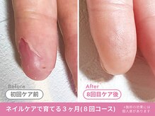 フェリエ(feerie)/Before/After【feerie立川】