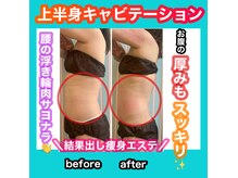 ハード系施術で手が届きにくい箇所までガッツリ引き締め！