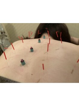 首・肩のつらさを改善したい