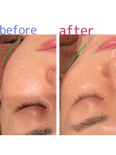 ヨシザワ インク 横浜みなとみらい桜木町店(YOSHIZAWA Inc.)/マッサージメニューも人気です！