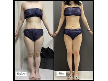 エムズビューティーサロン(M's Beauty Salon)/お客様Before After