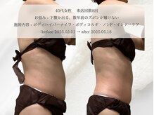 エメ(aimer)/BodyCare《痩身・代謝アップ》