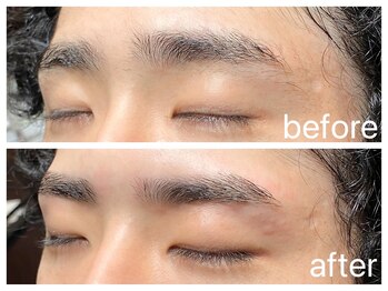 クラシックス(CLASSICS)/before &after