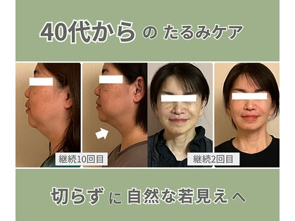 ベルソー(Berceau)の写真