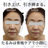 ミエル(Miel)