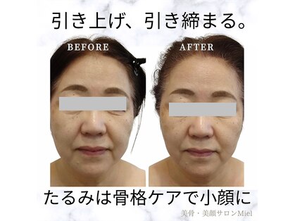 ミエル(Miel)の写真