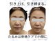 ミエル(Miel)の写真