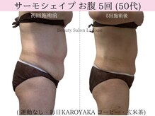 ラエッセ(La Esse)/たるんだ皮膚もケアできます！