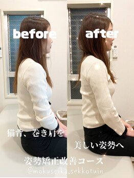 木犀花/姿勢矯正改善コース