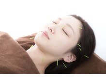 まつの鍼灸院の雰囲気（1番人気の刺す美容鍼!リフトアップの即効性を求める方にオススメ）