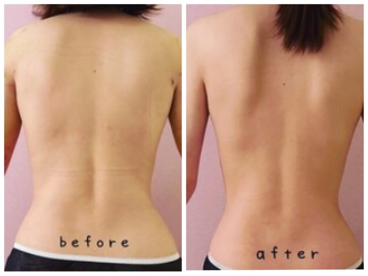 3ページ目｜大阪市でインディバが人気のエステサロン｜ホットペッパー