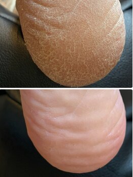 ネイルユア(NAIL YUA)の写真/足裏のガサガサ悩み、それ当店で解決できます！見えないところまで手を抜かない◇しっかり角質ケア♪
