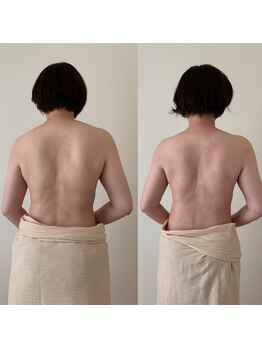 ピリリコ 白金台/痩身　ビフォーアフター