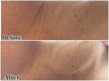 エミマス ボーテ(Emimas Beaute’)/幹細胞　気になる首のシワにも◎