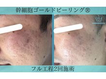 リメイク 広尾(REMAKE)/