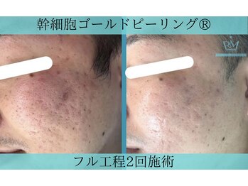 リメイク 広尾(REMAKE)/