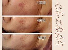 エステサロン カラーズ(COLORS)