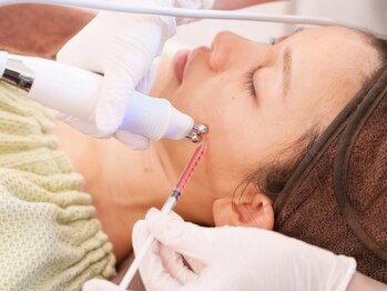 40代からの肌管理サロンB’S STYLE 【美肌育成／毛穴洗浄／たるみケア】の写真/【脱・もたつき肌宣言】韓国発最新脂肪分解美容液レッドショットリフトアップフェイシャル＊スッキリ小顔へ