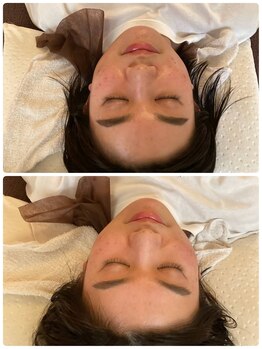 リックス整体/お顔のむくみやエラ目の疲れに