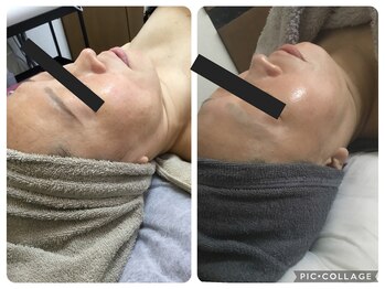 Hb 与野/マッサージリフトアップケア