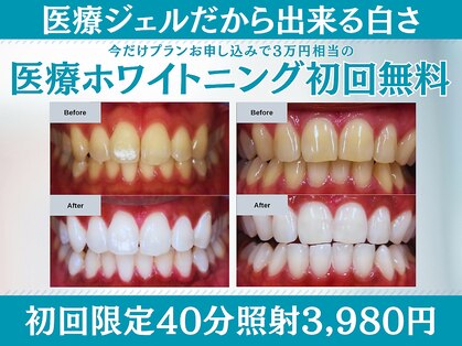 スマイルホワイト 赤羽店の写真
