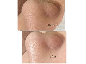 シレーナギンザ(SIRENA GINZA)