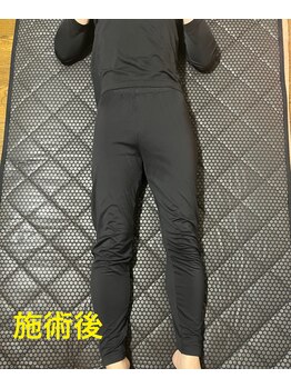 ヨサパーク ピュアン(YOSA PARK)/骨盤の歪みも矯正