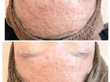 クリアー(CLEAR.)/【Before＆After】