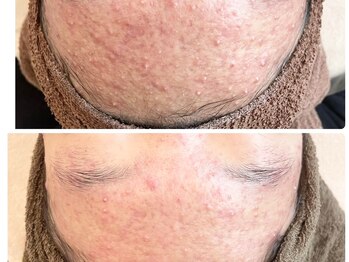 クリアー(CLEAR.)/【Before＆After】