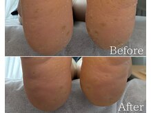 カシェット 広島店(Cachette)/60代女性☆足裏角質ケア90分