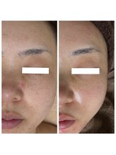 ジャスミン(Jasmine)/