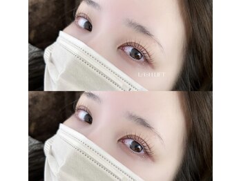 アニュ バイ リボーン(anu by Re born)/ラッシュリフト