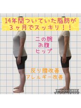よこた針灸整骨院/健康体に出来る耳つぼダイエット