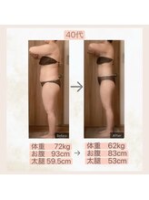 エメカシワ(Aimer KASHIWA)/40代　6ヶ月での変化