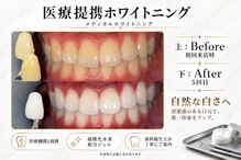 プリマ 前橋店