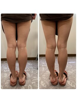 エスポワール(Espoir)/フットマッサージ