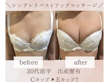 エスグレース 梅田店(S.grace)/痩身と育乳