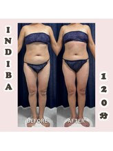 トレス(Tres)/インディバ120分