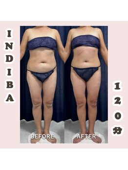 トレス(Tres)/インディバ120分