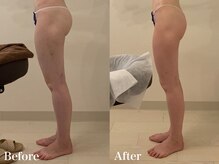 ラヴィエ ベル(La vie est belle)/太腿の前張を薄く！！