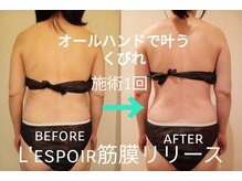 レスポワール(L'espoir)の雰囲気（リピート2回目のお客様！2回目の施術1回効果！）