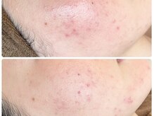 クリアー(CLEAR.)/【Before＆After】