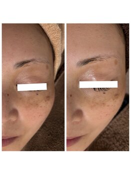 ジャスミン(Jasmine)/